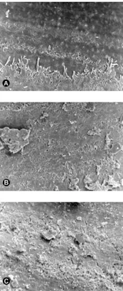 Figure  2.  Representative  samples  of  Rinsendo  system.  A 