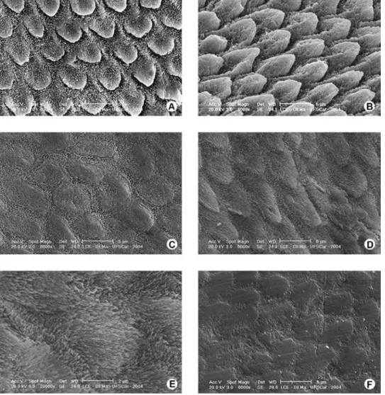 Figure 1. Enamel immersed in the cola-type soft drink. A = After 7-day immersion, there was great demineralization, especially on  the interprismatic portion