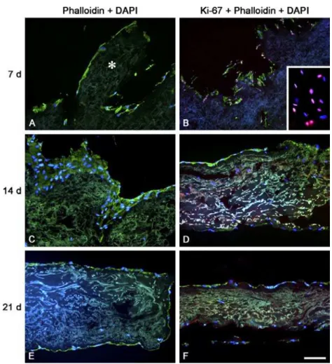 Table 1 shows the relative proportions of adherent  cells on the ADM slices, namely border, transition and  central; their location (at the surface or inside the ADM)   is  shown  in  Figure  1