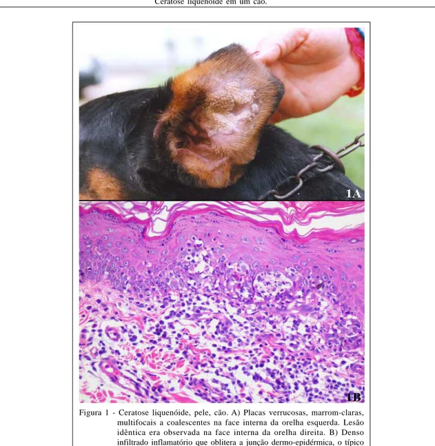 Figura 1 - Ceratose liquenóide, pele, cão. A) Placas verrucosas, marrom-claras, multifocais a coalescentes na face interna da orelha esquerda