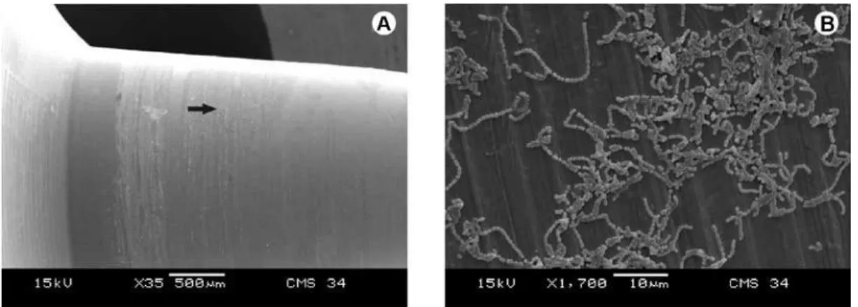 Figure 2. SEM micrograph of the Morse taper with universal post. A: Middle area of the abutment showing bacterial growth on the  surface; B: Higher magnification of the area pointed by the arrow shows bacterial cells on the surface.