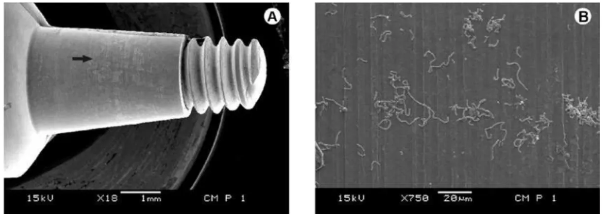 Figure 3. SEM micrograph of the Morse taper with universal post through bolt. A: Middle area of the abutment showing bacterial  growth on the surface; B: Higher magnification of the area pointed by the arrow shows bacterial cells on the surface.