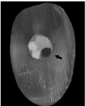 Figure 1. Apical cross-section of the root canal filling showing  the nylon thread used to simulate the void (arrow)