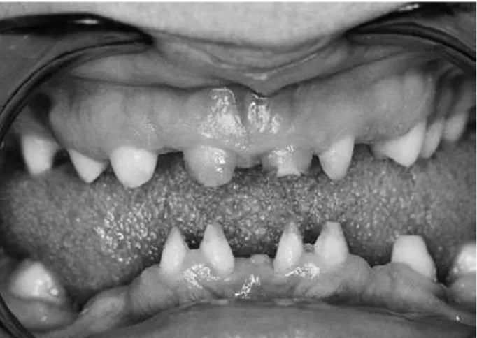 Figure 4. Intraoral clinical appearance after the completion of the restorative treatment
