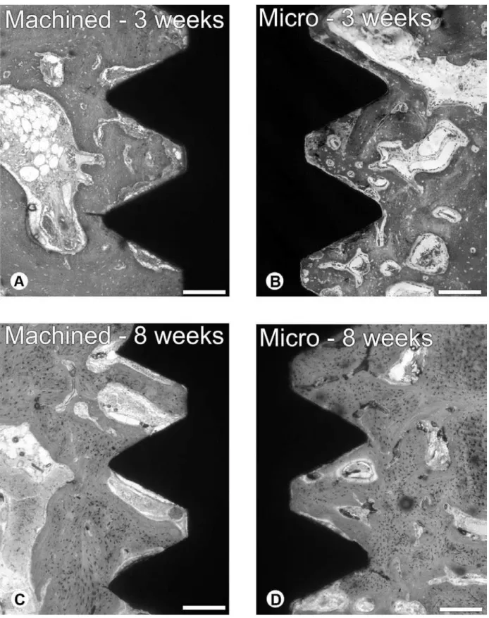 Figure 1. Mesiodistal ground sections of machined (A,C) and micro (B,D) Ti implants and the surrounding connective tissues at 3  (A,B) and 8 (C,D) weeks postimplantation