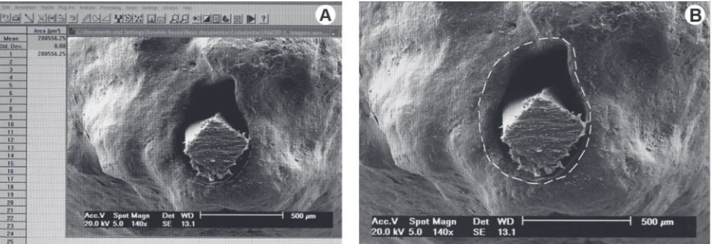 Figure 1. Measurement of the apical foramen area using the Image Tool Software. A= Observe the line demarcating the foraminal  area; B= Same image as in A seen in detail.