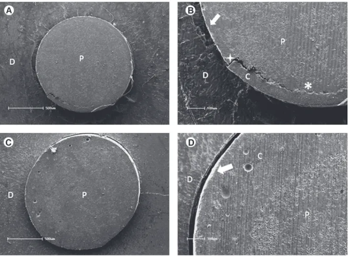 Figure 1. Scanning electron micrographs of representative fracture patterns. A mixed failure mode in the apical third for RelyX U100  can be seen in low (A) and high magnification (B)