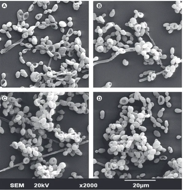 Figure 2. SEM micrograph showing the morphology and structure of SSB of C. albicans (Original magnification ×2000)