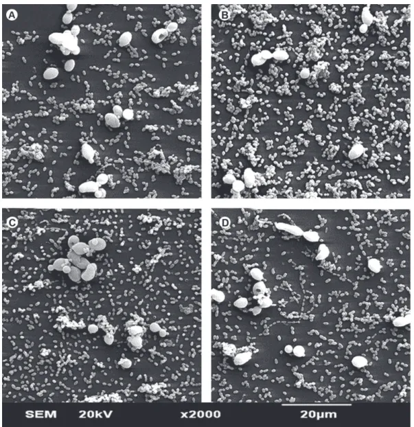Figure 3. SEM micrograph showing the morphology and structure of DSB (S. mutans plus and C