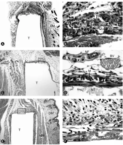 Figure 1. Calen/ZO: A and B = At 7 days, macrophages (M), fibroblast bundles (arrows in A), polymorphonuclear neutrophils (N)  and areas of coagulation necrosis (CN) were observed (HE; A = ×4 and B = ×100)