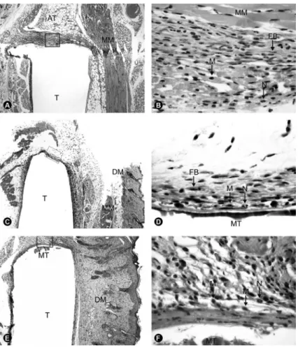 Figure 3. ZOE: A and B = At 7 days, no material fragments are observed. Macrophages (M) and neutrophils (N) are present at interface  with the material