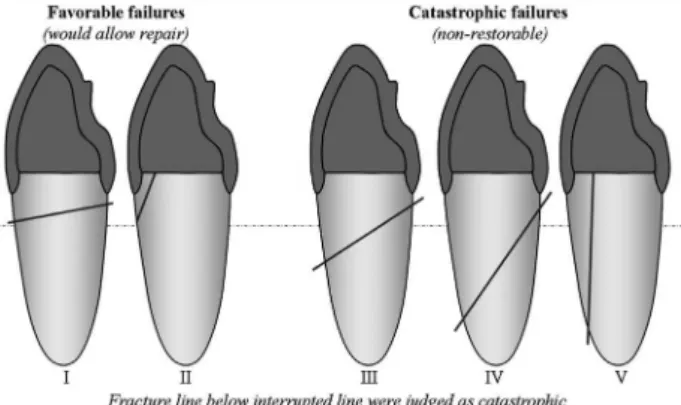 Figure 3. Mechanical fatigue device. Figure 4. Schematic illustration of the failure mode classification.