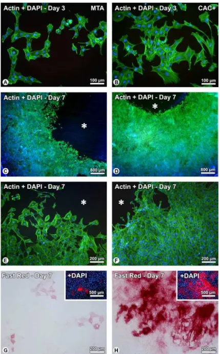 Figure 1. Calvaria-derived osteogenic cell cultures grown on glass coverslips in the presence of either MTA (A,C,E,G) or CAC+ (B,D,F,H)  samples at days 3 (A,B) and 7 (C-H)