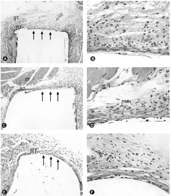 Figure 1. Microscopic aspects of the tissue reaction (RT) at 7 days (A, B), 21 days (C, D) and 63 days (E, F) at the interface (arrows)  between the implanted materials and the surrounding tissue (ST)