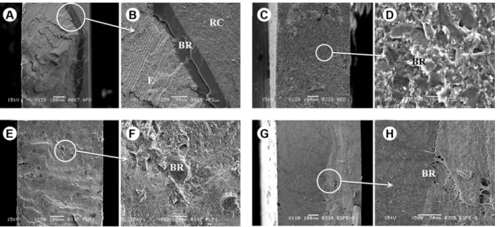 Figure 3. Representative SEM micrographs illustrating the fractured surfaces of the enamel side of the specimens