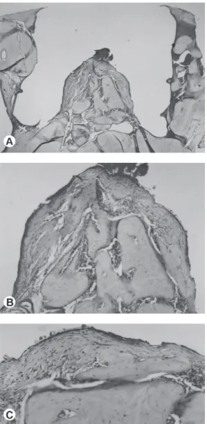Figure 5. Host tissue reaction to the Guedes Pinto paste after 12  weeks of bone implantation