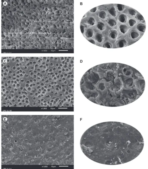 Figure 2. A, B: 0.2% CPC, coronal third, SEM ×1,600 (A) and ×5,000 (B). C, D: 0.2% CPC, middle third, SEM ×1,600 (C) and ×5,000  (D)