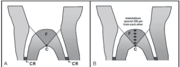 Figure  1.  A:  Delimited  furcation  area,  showing  the  analyzed  region (F), maximum concavity point of the furcation area (C),  composite resin restoration (CR)