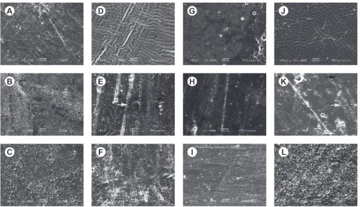 Figure  2.  SEM  micrograph  of  Biscover  LV  after  6  months  of  toothbrushing.