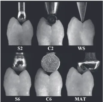 Figure 1. Dimension of cavity preparation design. A: Occlusal  box depth (2.5 mm). B: Axial wall height (1.5 mm)