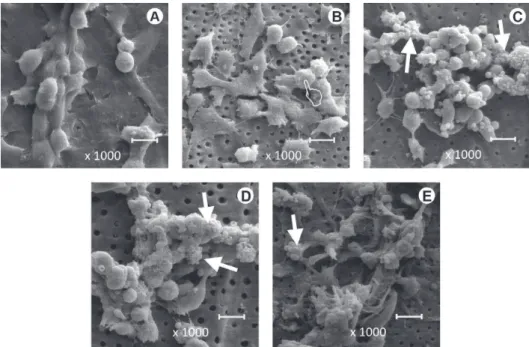 Figure 2. SEM images of MDPC-23 cells adhered to dentin discs in control and experimental groups
