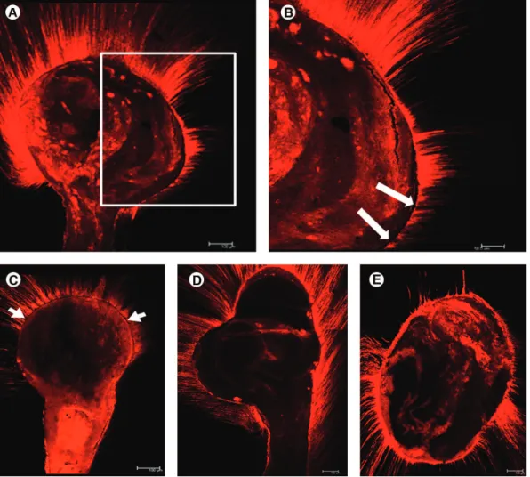 Figure 4. Representative images of the RealSeal SE/System B technique (A-C). Magnification of the interface shows a typical gap  between sealer and the surrounding dentin (white arrows in B); Representative images of canals filled with ThermaSeal Plus/Syst