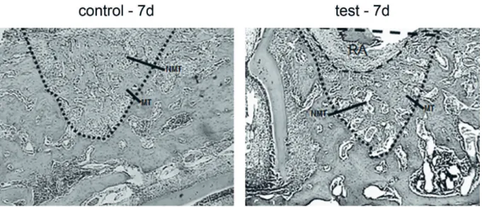 Figure 2. Photomicrograph illustrating new bone formation at 7 days (control and test groups)