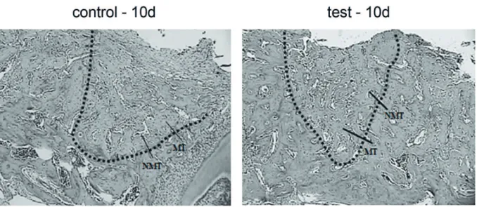 Figure 3. Photomicrograph illustrating new bone formation at 10 days (control and test groups)