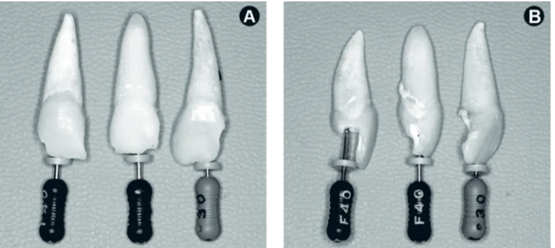 Figure 2. Shape of the maxillary central incisor roots. Observe the slightly curved roots