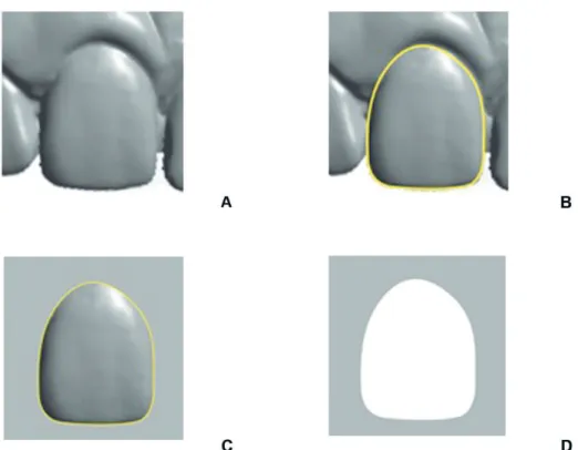 Figure 2. 3D scans of the maxillary right incisor. A= Tooth exported; B= Delimitation of tooth morphology; C= Isolated image of the  incisor crown; D= Negative image of the crown