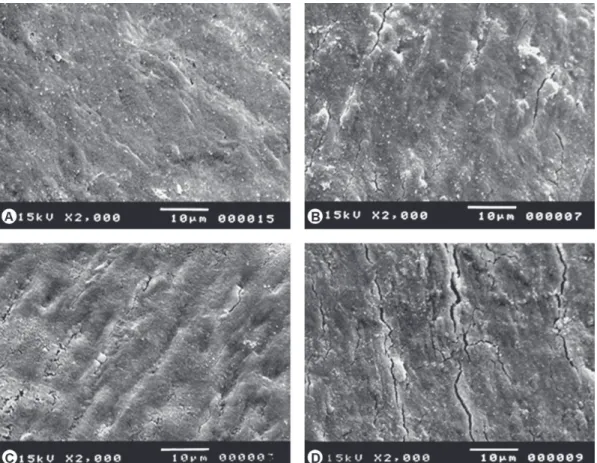 Figure 1. Dentin surface after the bleaching protocols: A) Unbleached (control)  - smear layer covering the dentinal tubules; B and C)  Sodium perborate + 20% hydrogen peroxide and 37% carbamide, respectively - smear layer covering the dentinal tubules and