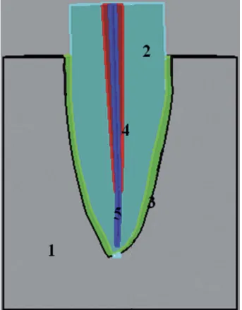 Table 4 presents the type of failure that occurred after  fracture strength testing.