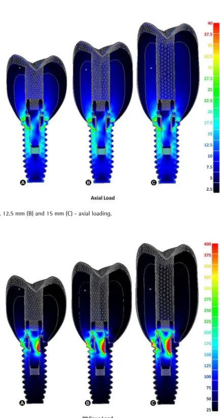 Figure 2. Crowns 10 mm (A), 12.5 mm (C) and 15 mm (C) - oblique loading. 