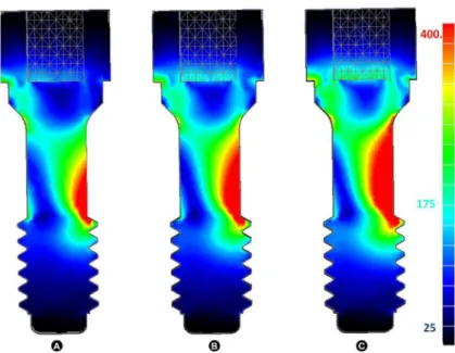 Figure 4. Screw section - oblique loading. Crowns 10 mm (A), 12.5 mm (C) and 15 mm (C).