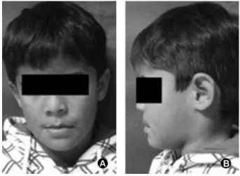 Figure 1. Physical examination of the patient (A, B). Hypochromic  slight on skin.