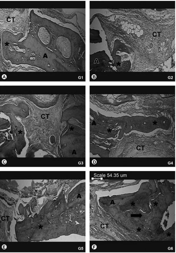 Figure 3. Photomicrographs of the implant site in animals of the groups studied. Note the new bone (*) formed in all groups and projected from autograft  graft (A) and margins in bone defect