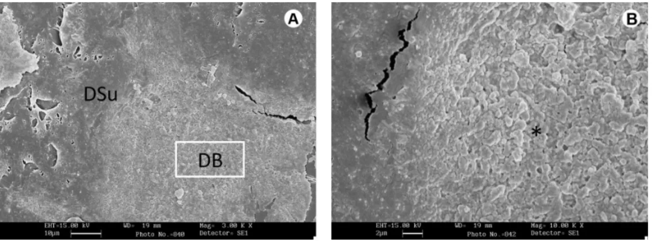 Figure 2. After MW+B (SEM 3,000×). A: Presence of biofilm probably formed by non-viable microorganisms