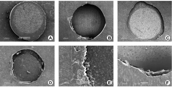 Figure 1. Failure modes. A-C: Adhesive at cement/dentin interface. D: Mixed. E: A high magnification (170×) of image ‘D’: adhesive at cement/post  interface