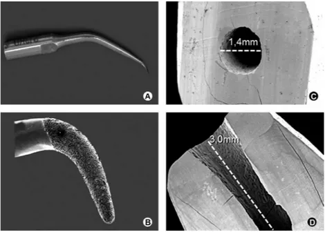 Figure 1. A: Diamond tip. B: SEM micrograph of the P15 diamond tip. C: SEM micrograph of  a tooth with apicoectomy and root-end cavity