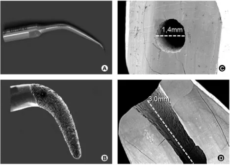 Figure 1. A: Diamond tip. B: SEM micrograph of the P15 diamond tip. C: SEM micrograph of  a tooth with apicoectomy and root-end cavity