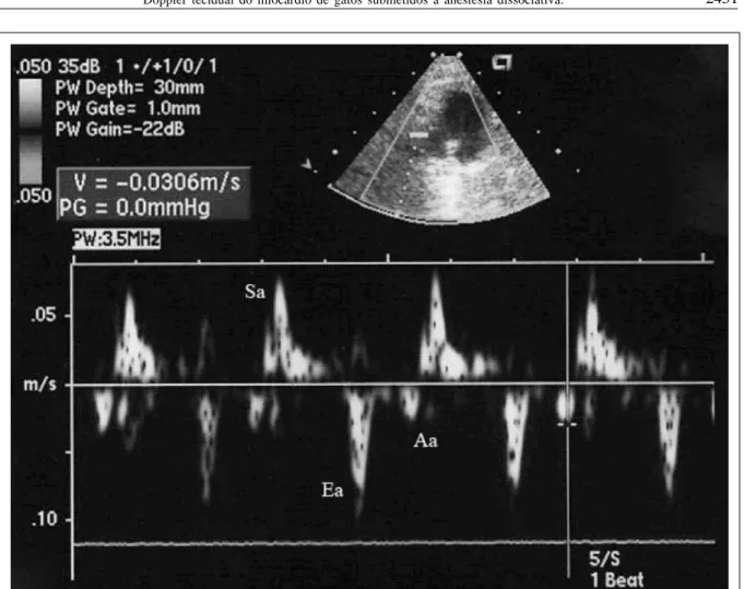 Figura 2 - Imagem ecocardiográfica bidimensional e em Doppler tecidual pulsado da velocidade de movimentação do miocárdio de gato saudável