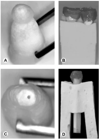 Figure 1. Closed system (A). Closed system mounted in alginate  (B). Open system (C). Open system mounted in alginate (D)