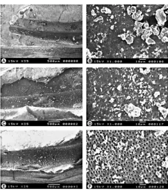 Figure 2. SEM micrographs representative of the 30.02 group. A: Apical  third with presence of debris along canal (35 × )