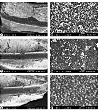 Figure 5. SEM micrographs representative of group 45.02. A: Apical  third with presence of debris along canal (35×)