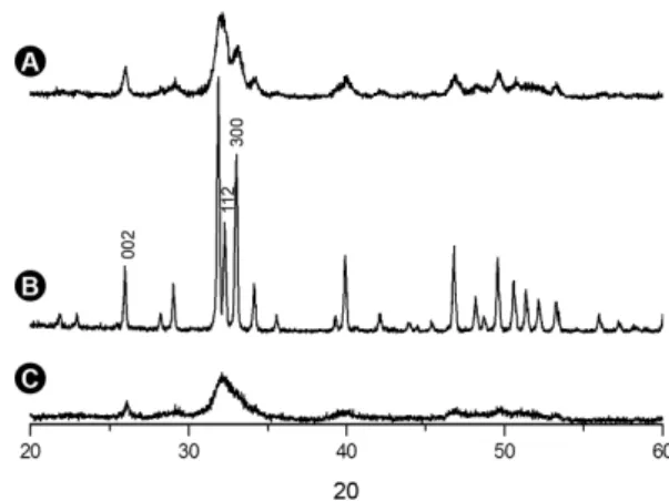 Figure 8. Release of calcium at 7 h (A), 24 h (B), 48 h (C), 72 h (D) and  168 h (E). XX Axis: Material (A, Bio-Oss ® ; B, Genox  ® ; C, Bonefill ® )