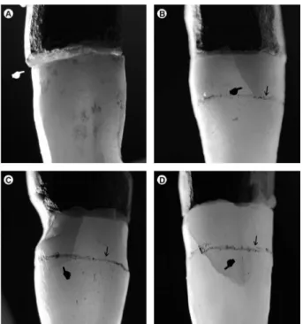 Figure 3. Failure patterns. Favorable: A, displacement of the crown and/