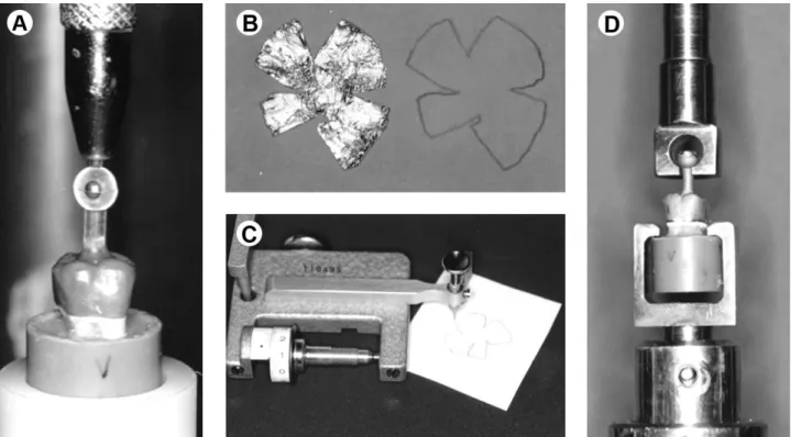 Figure 1. A: Sprue on the occlusal crown surface. B: Limits of the cementation area. C: Measurement of area in the planimeter