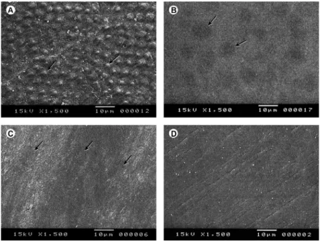 Table 2. Mean values in KHN and microhardness variation before and after the exposure times