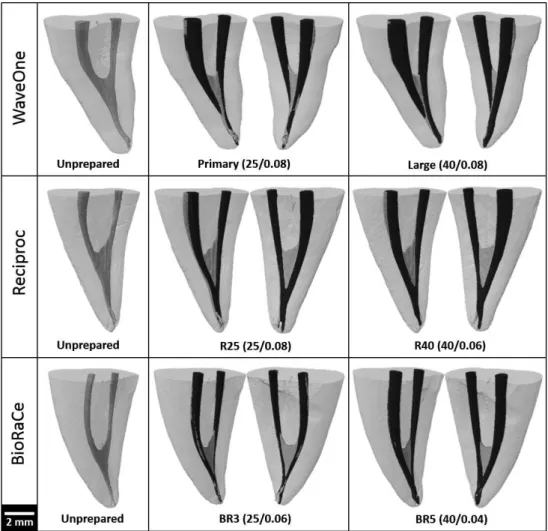 Figure 2. Representative 3D reconstructions of the external and internal anatomy of mesial roots of mandibular molars from each experimental group,  before and after root canal preparation