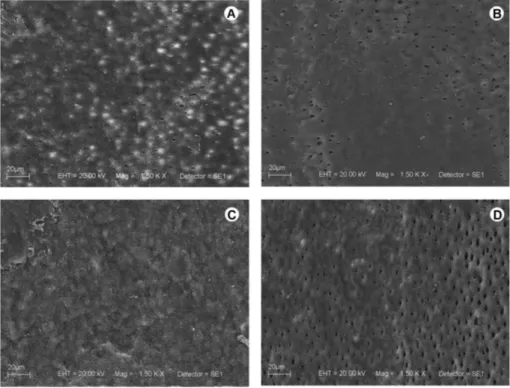 Figure 4. SEM images after intraoral phases. A: Fluoride varnish. B: Non-fluoride varnish